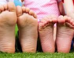 Afbeelding bij Inloopspreekuur kindervoeten