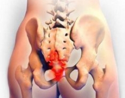 Afbeelding bij Bekkenfysiotherapie