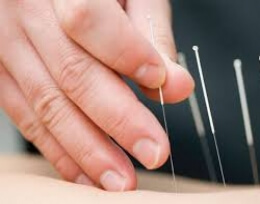 Afbeelding bij: Dry Needling