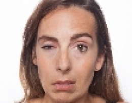 Afbeelding bij Aangezichtsverlamming Afbeelding bij Aangezichtsverlamming